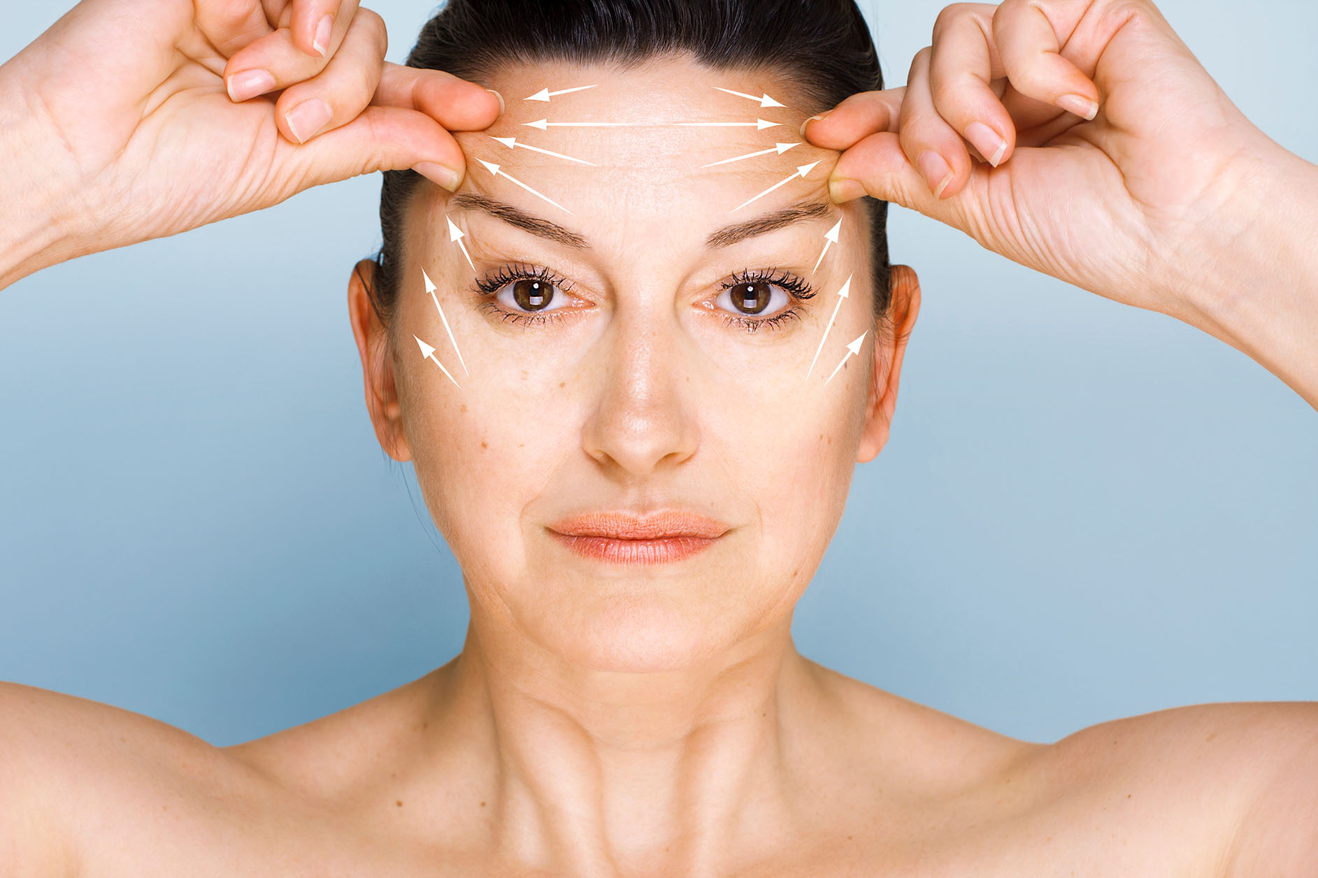 woman lifting her forehead wrinkles with guidelines showing lifting direction